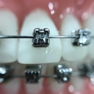 zoom, orthodontics, iphone, orthodontics, orthodontics, orthodontics, orthodontics, orthodontics